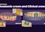 create precise exocad cad designs for dental labs